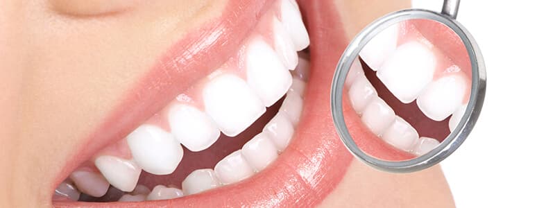 Dentisterie esthétique au Cabinet Dr Heni KHELIFI à Sassenage - Facettes céramique et blanchiment dentaire